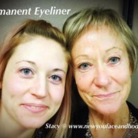 Happy Mother and Daughter client of New You Face and Body.
